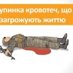 Презентація “Зупинка кровотеч, що загрожують життю”