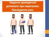 Презентація “Надання домедичної допомоги при переломах”