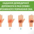 Презентація “Надання домедичної допомоги в разі опіків і проникного поранення ока”