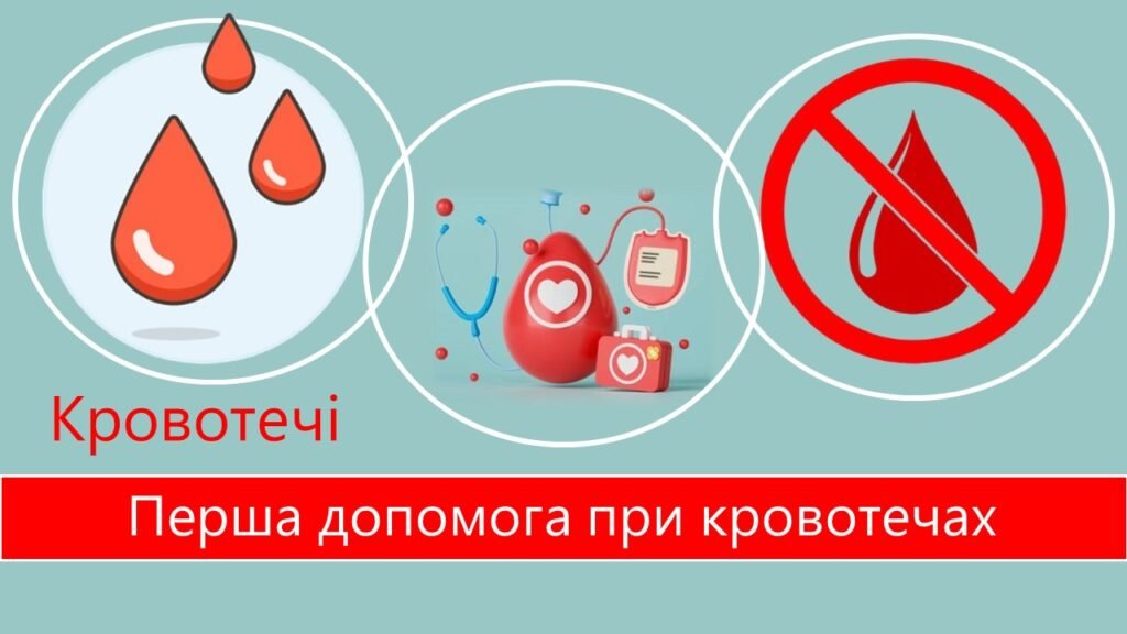 Головне зображення розробки: Презентація “Кровотечі. Перша допомога при кровотечах”