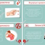 Фото розробки: Презентація “Кровотечі. Перша допомога при кровотечах”